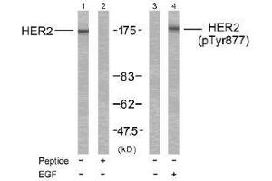Image no. 2 for anti-Receptor tyrosine-protein kinase erbB-2 (ErbB2/Her2) (Tyr877) antibody (ABIN197223) (ErbB2/Her2 anticorps  (Tyr877))