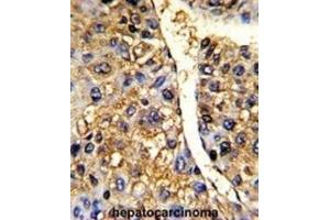 Immunohistochemistry (IHC) image for anti-Tu Translation Elongation Factor, Mitochondrial (Tufm) antibody (ABIN3001714) (TUFM anticorps)