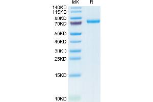 Human DSG3 on Tris-Bis PAGE under reduced condition. (Desmoglein 3 Protein (DSG3) (AA 50-615) (His tag))