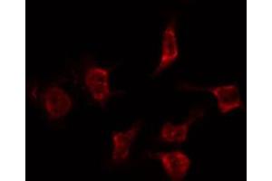 ABIN6268904 staining Hela by IF/ICC. (Cyclin F anticorps  (C-Term))