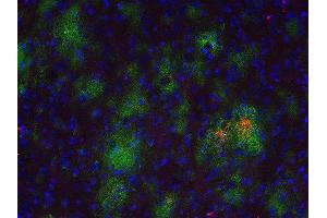 Indirect immunostaining of a PFA fixed formic acid treated brain section from a triple transgenic Alzheimer´s disease mouse with anti-Abeta 40 (dilution 1 : 500; red) and rabbit anti-Abeta (cat.