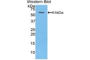 Western blot analysis of the recombinant protein. (THBS4 anticorps  (AA 644-925))