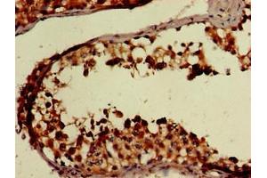 Immunohistochemistry of paraffin-embedded human testis tissue using ABIN7152652 at dilution of 1:100