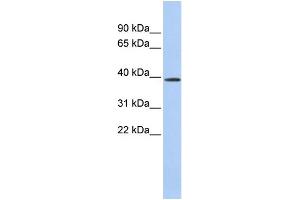 WB Suggested Anti-CLN6 Antibody Titration:  0. (CLN6 anticorps  (Middle Region))