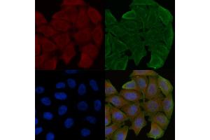 ABIN6259458 and ABIN6275227 staining Hela cells(30 min of UV treatment) by IF/ICC.
