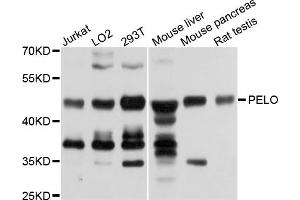 Western blot analysis of extracts of various cell lines, using PELO antibody (ABIN5972746) at 1/1000 dilution. (PELO anticorps)