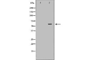 Western blot analysis of Hela whole cell lysates, using TCP1  Antibody. (TCP1 alpha/CCTA anticorps  (C-Term))