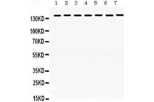 Western Blotting (WB) image for anti-Structural Maintenance of Chromosomes 3 (SMC3) (AA 1178-1216), (C-Term) antibody (ABIN3043343) (SMC3 anticorps  (C-Term))