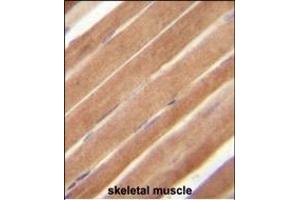 EphB2 Antibody (N-term) A immunohistochemistry analysis in formalin fixed and paraffin embedded human skeletal muscle followed by peroxidase conjugation of the secondary antibody and DAB staining.