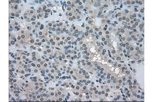 Image no. 1 for anti-Lactate Dehydrogenase A (LDHA) antibody (ABIN1499114)