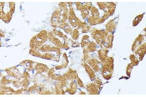 Immunohistochemistry of paraffin-embedded Rat heart using TRAP1 Polyclonal Antibody at dilution of 1:100 (40x lens).