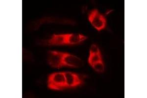 Immunofluorescent analysis of HFE staining in MCF7 cells. (HFE anticorps)