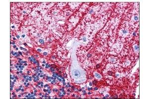 Human Brain, Cerebellum: Formalin-Fixed, Paraffin-Embedded (FFPE) (SIPA1L3 anticorps  (N-Term))