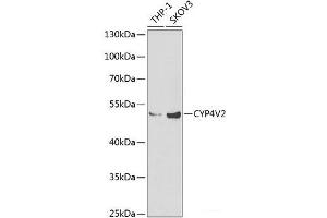 Western blot analysis of extracts of various cell lines using CYP4V2 Polyclonal Antibody at dilution of 1:1000.