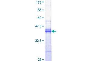 Epidermal Growth Factor (EGF) (AA 926-1025) protein (GST tag)
