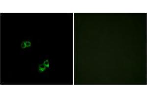 Immunofluorescence analysis of MCF7 cells, using MC5R Antibody. (MC5 Receptor anticorps  (AA 271-320))