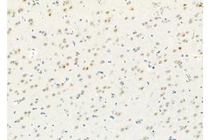 ABIN6257927 and ABIN6274304 at 1/100 staining Rat brain tissue by IHC-P.