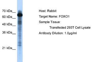 WB Suggested Anti-FOXO1 Antibody   Titration: 1. (FOXO1 anticorps  (C-Term))