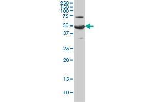 ADCYAP1R1 monoclonal antibody (M01), clone 2B12 Western Blot analysis of ADCYAP1R1 expression in HeLa . (ADCYAP1R1 anticorps  (AA 21-120))