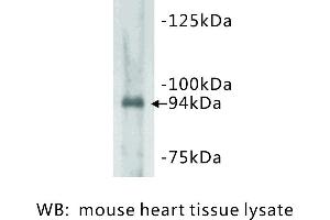 Image no. 1 for anti-Junctophilin 2 (JPH2) antibody (ABIN1112815)