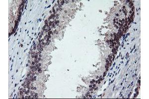 Image no. 4 for anti-Protein Phosphatase 1, Regulatory (Inhibitor) Subunit 15A (PPP1R15A) antibody (ABIN1498364)