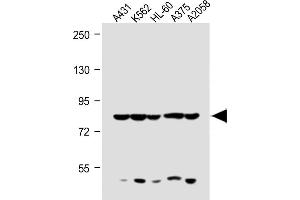 All lanes : Anti-ABCB5 Antibody (N-term) at 1:1000 dilution Lane 1: A431 whole cell lysate Lane 2: K562 whole cell lysate Lane 3: HL-60 whole cell lysate Lane 4:  whole cell lysate Lane 5:  whole cell lysate Lysates/proteins at 20 μg per lane.