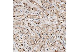 IHC analysis of SNRNP40 using anti-SNRNP40 antibody (ABIN7601719). (SNRNP40 anticorps  (AA 43-357))