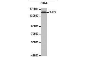 Western Blotting (WB) image for anti-Tight Junction Protein 2 (Zona Occludens 2) (TJP2) antibody (ABIN1875103)