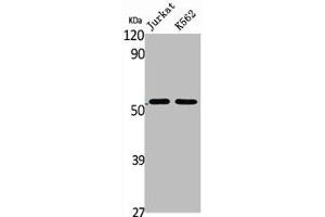 Western Blot analysis of Jurkat K562 cells using BAGE5 Polyclonal Antibody (BAG5 anticorps  (N-Term))