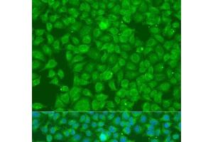 Immunofluorescence analysis of U2OS cells using SLC25A6 Polyclonal Antibody at dilution of 1:100. (SLC25A6 anticorps)