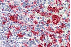 Human Spleen (formalin-fixed, paraffin-embedded) stained with HMOX1 antibody ABIN462108 at 10 ug/ml followed by biotinylated goat anti-rabbit IgG secondary antibody ABIN481713, alkaline phosphatase-streptavidin and chromogen.