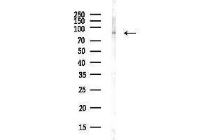 Western blot analysis of lysates from COLO205 cells(heat-shock,45 min treatment), using Sir Antibody at 1/1000 dilution.