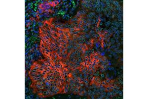 Immunofluorescence (IF) image for anti-CD274 (PD-L1) (C-Term) antibody (ABIN7454042) (Recombinant PD-L1 anticorps  (C-Term))