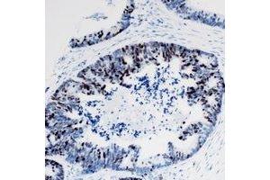 Immunohistochemistry (IHC) image for anti-TIA1 Cytotoxic Granule-Associated RNA Binding Protein (TIA1) antibody (ABIN7308408) (TIA1 anticorps)