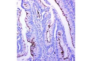 Immunohistochemistry (Paraffin-embedded Sections) (IHC (p)) image for anti-Profilin 2 (PFN2) (AA 125-140), (C-Term) antibody (ABIN3042861)