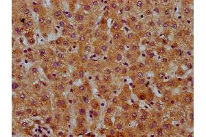 IHC image of ABIN7169368 diluted at 1:600 and staining in paraffin-embedded human liver tissue performed on a Leica BondTM system. (SAA2 anticorps  (AA 19-94))