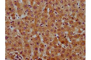 IHC image of ABIN7169368 diluted at 1:600 and staining in paraffin-embedded human liver tissue performed on a Leica BondTM system.