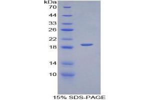 SDS-PAGE of Protein Standard from the Kit (Highly purified E. (CD31 Kit ELISA)