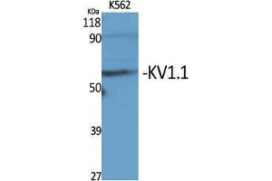 Western Blot (WB) analysis of specific cells using KV1. (KCNA1 anticorps  (Internal Region))