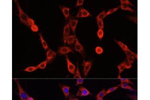 Immunofluorescence analysis of NIH/3T3 cells using ABCD1 Polyclonal Antibody at dilution of 1:100. (ABCD1 anticorps)