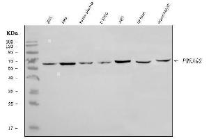 Western blot analysis of PRKAG2 using anti-PRKAG2 antibody (ABIN7600844).