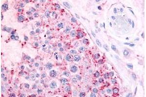 Immunohistochemical staining of human testis with MAS1 polyclonal antibody . (MAS1 anticorps  (Extracellular Domain))