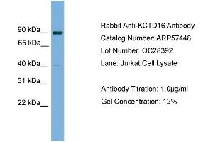 WB Suggested Anti-KCTD16  Antibody Titration: 0. (KCTD16 anticorps  (N-Term))