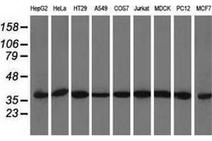 Western blot analysis of extracts (35 µg) from 9 different cell lines by using anti-ACAT2 monoclonal antibody. (ACAT2 anticorps)