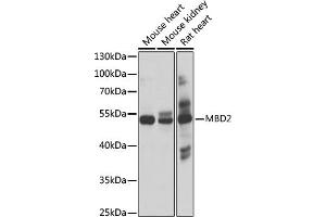 Western blot analysis of extracts of various cell lines, using MBD2 antibody (ABIN1680781, ABIN3015876, ABIN3015877 and ABIN6219461) at 1:1000 dilution. (MBD2 anticorps  (AA 202-411))