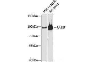 Western blot analysis of extracts of various cell lines using RASEF Polyclonal Antibody at dilution of 1:3000. (RASEF anticorps)