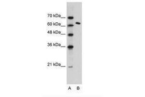 Image no. 1 for anti-FACT complex subunit SPT16 (SUPT16H) (AA 77-126) antibody (ABIN203368) (SUPT16H anticorps  (AA 77-126))