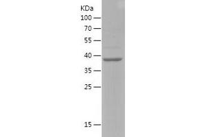 Western Blotting (WB) image for Transcription Factor EB (TFEB) (AA 43-200) protein (His-IF2DI Tag) (ABIN7125448)
