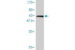 Western Blot detection against Immunogen (60. (TEX264 anticorps  (AA 1-313))