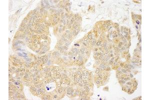 Immunohistochemistry (IHC) image for anti-Growth Factor Receptor-Bound Protein 10 (GRB10) (AA 100-150) antibody (ABIN7448583)